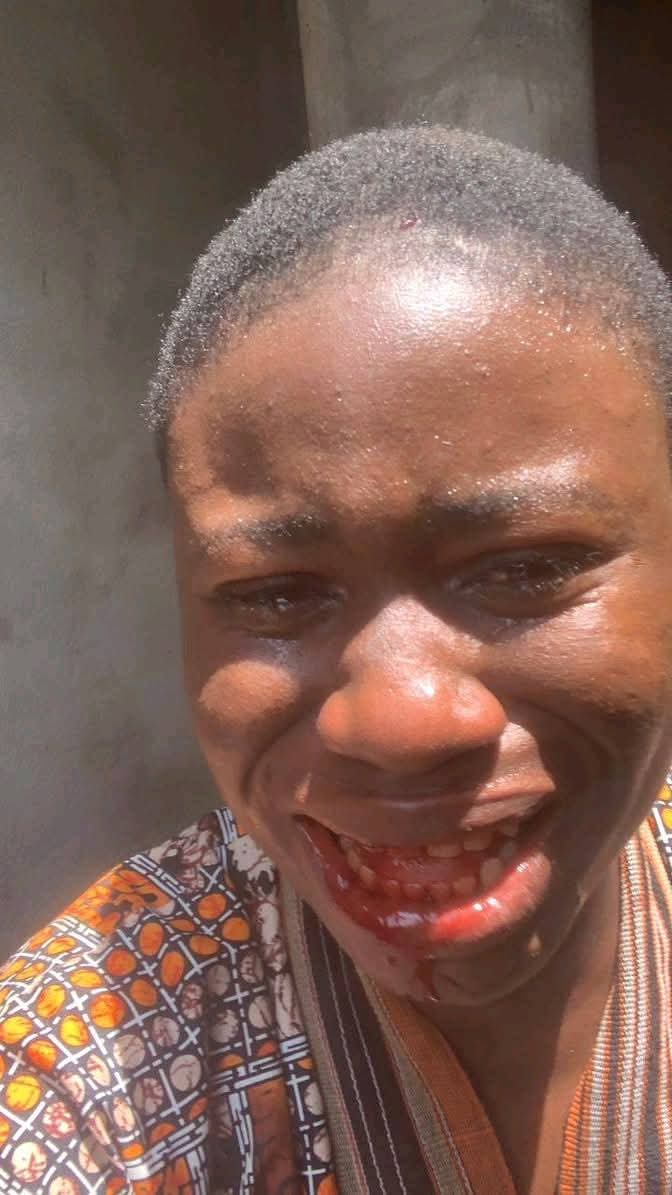 Miss Ogadinma allegedly assaulted by Ahoda Chairman for exposing deplorable condition of school