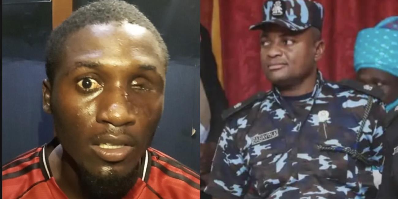 Barber Sues Police, Seeks N1bn Damages Over Alleged Loss of Eye During Bwari New Year Operation Barber Sues Police, Seeks N1bn Damages Over Alleged Loss of Eye During Bwari New Year Operation